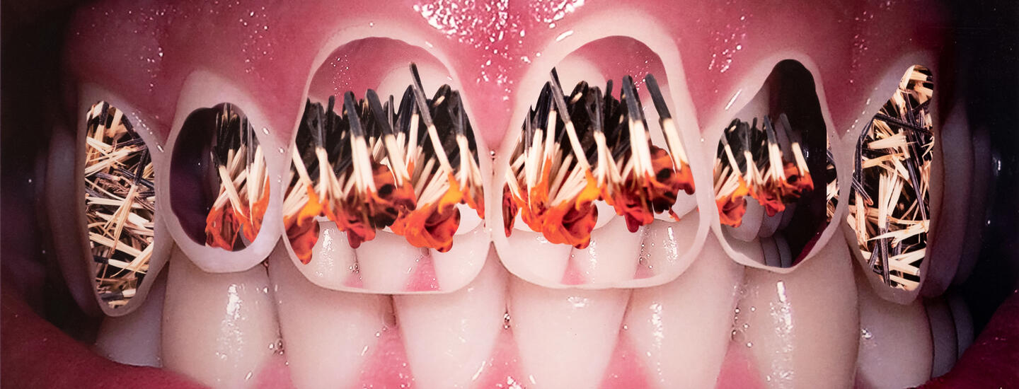 Bared human teeth with lit matchsticks filling the top row of teeth