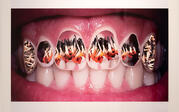 photo of teeth with matches